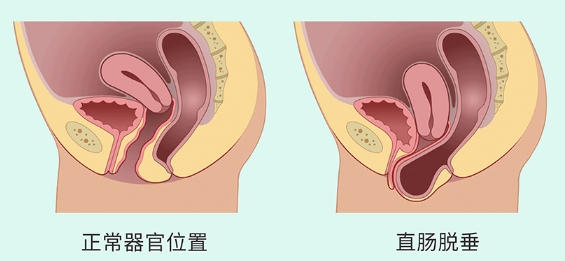 微信截图_20240515154513.png