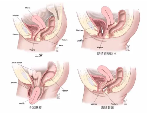 微信截图_20210911151802.png