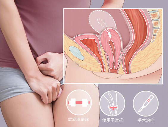 微信截图_20220913150550.png
